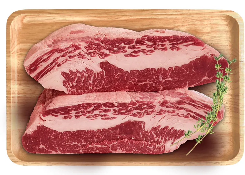 רצועות אונטריבDEVESA